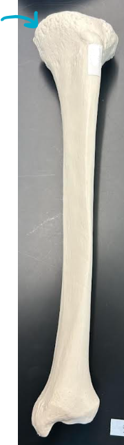 <p>ID tibia region </p>