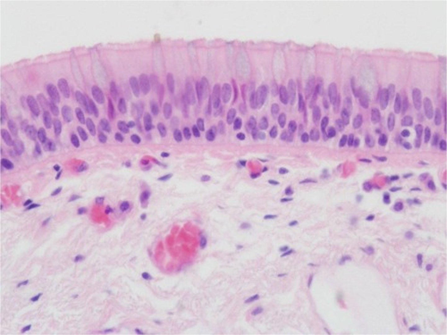 <p>Nuclei of cells are at different heights but each cell reaches the base; protective function</p><p>(larger respiratory passages, nasal cavity)</p>