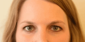 <p><span>Outer Brow Raiser (unilateral, right side)</span></p>