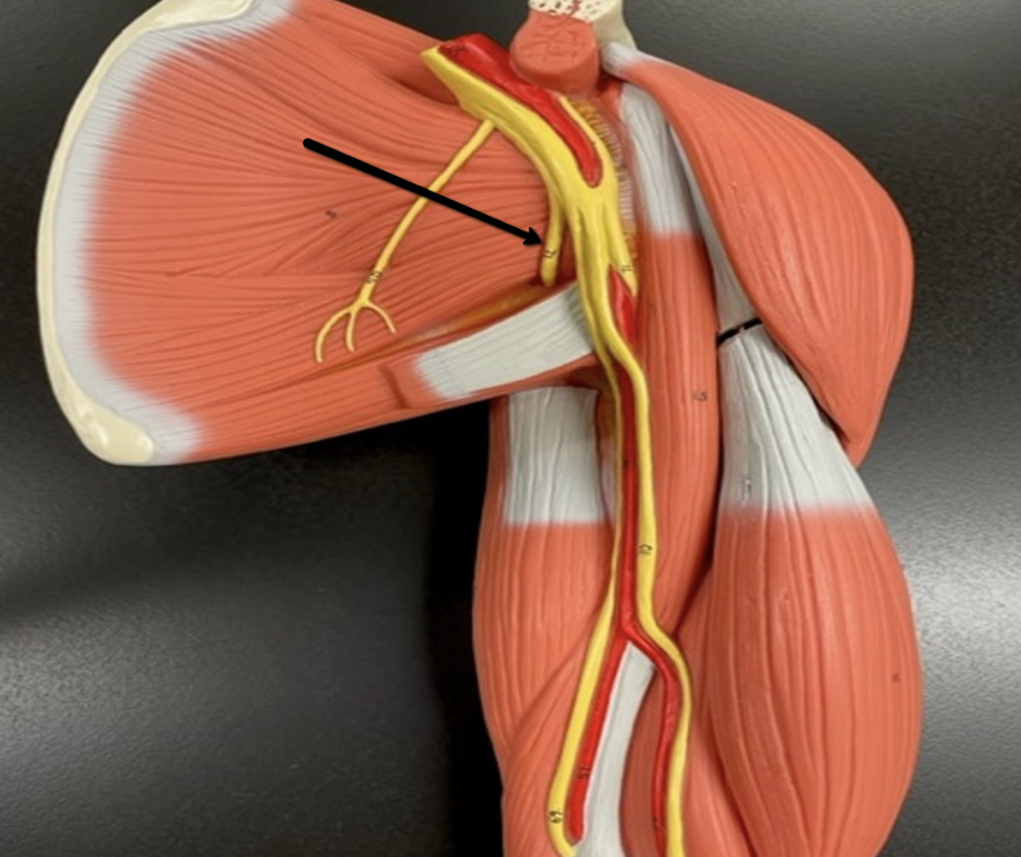 <p><span>Identify the nerve/cord indicated by the pointer.</span></p>