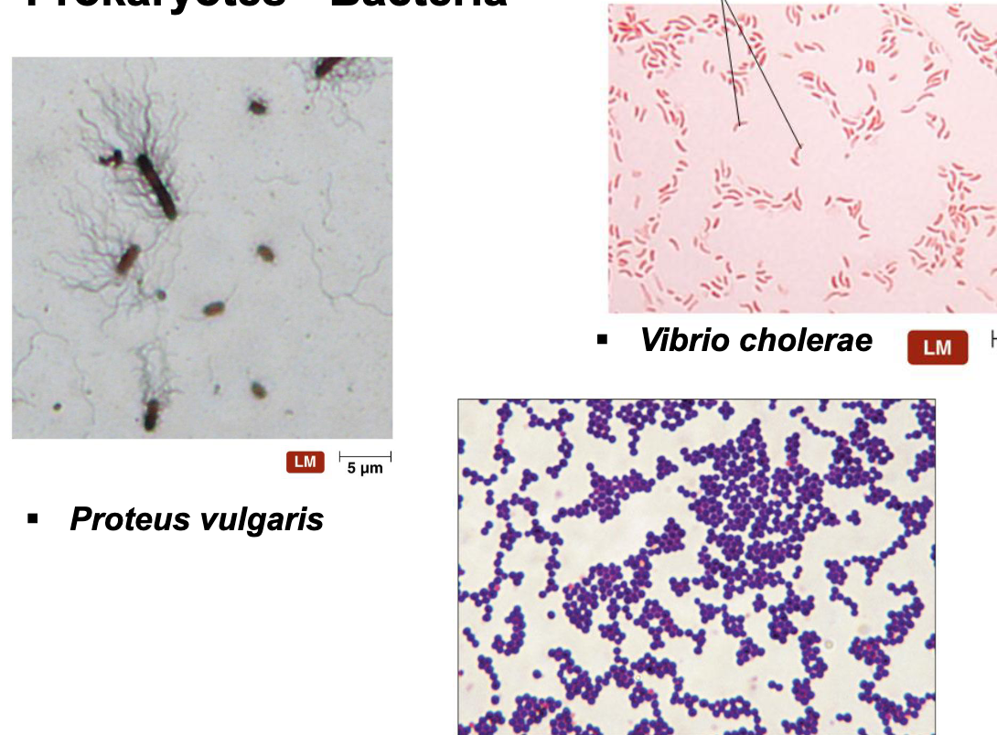 <ul><li><p><strong>…single-cell/unicellular prokaryotes</strong> → <strong>w/o membrane bound nucleus</strong></p></li><li><p>Have rigid cell wall → <strong>peptidoglycan</strong></p></li><li><p>Multiply via asexual reproduction→ <strong>binary fission</strong></p></li><li><p>move using <strong>flagella</strong></p></li></ul><p></p>