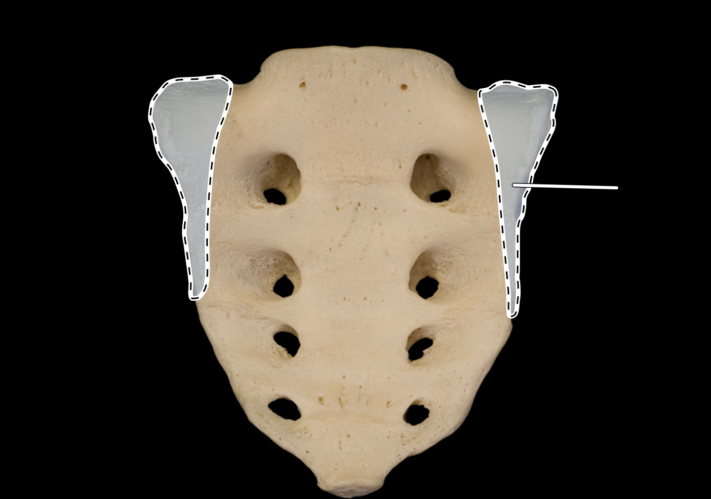 <p>anterior view</p>