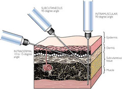 <p>intramuscular</p>