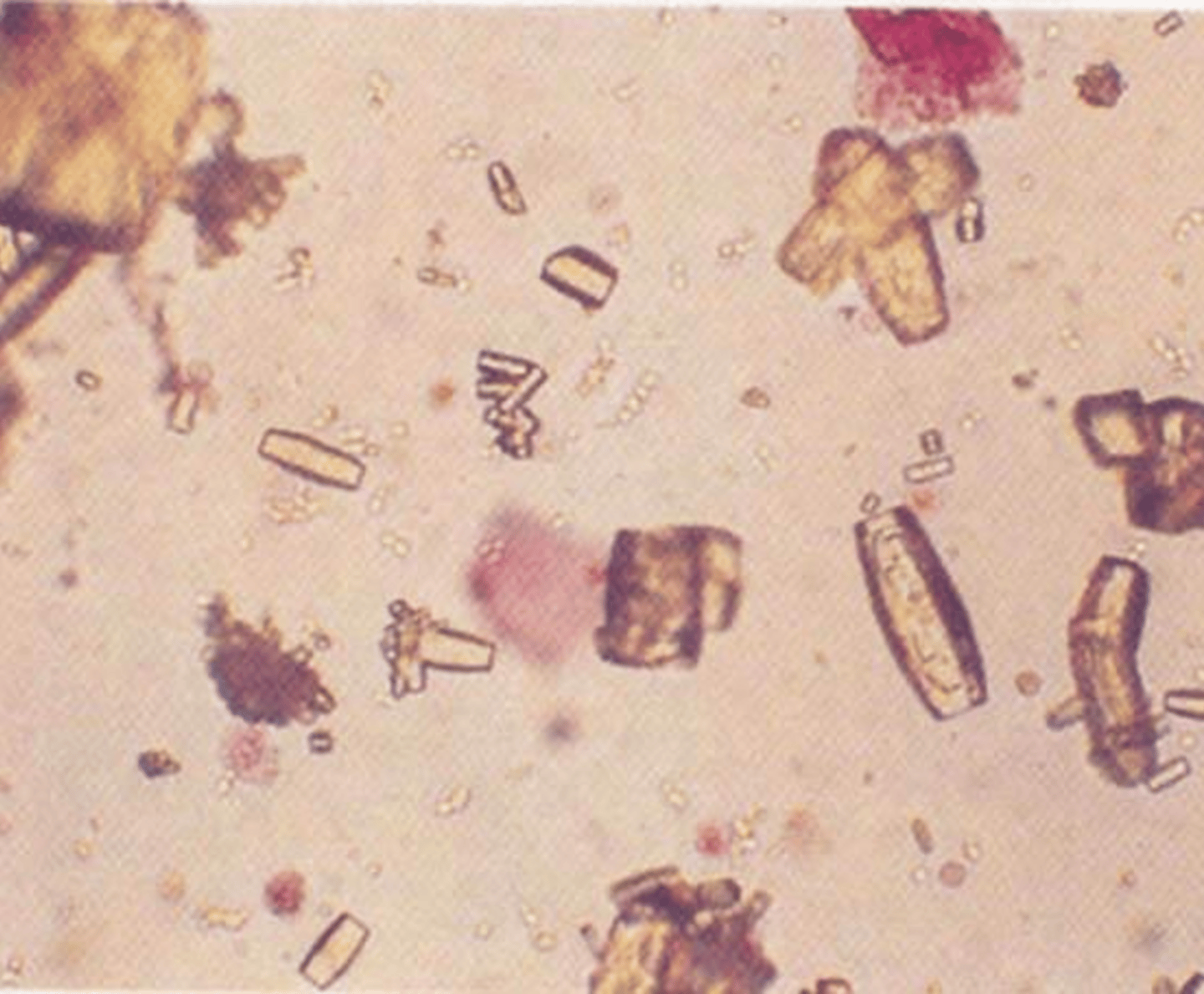 <p>pH <7.5</p>