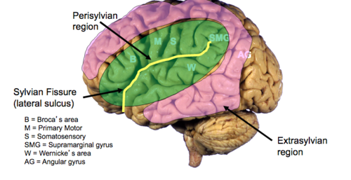 <p>Left perisylvian cortex</p>