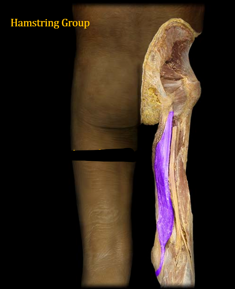 <p>What muscle is this?</p>