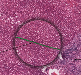 <p>what are interlobular vessels? septa?</p>
