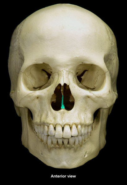 <p>What is the name of this bone?</p>