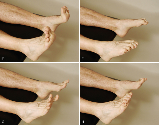 <p>Movements of Ankle?</p><p></p>