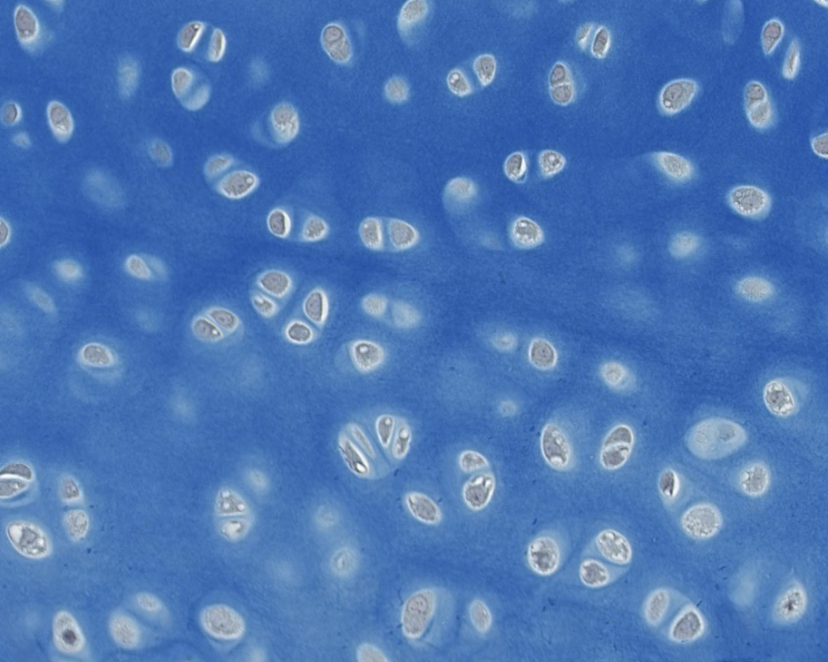 <p>Which type of CT is this? be specific</p>