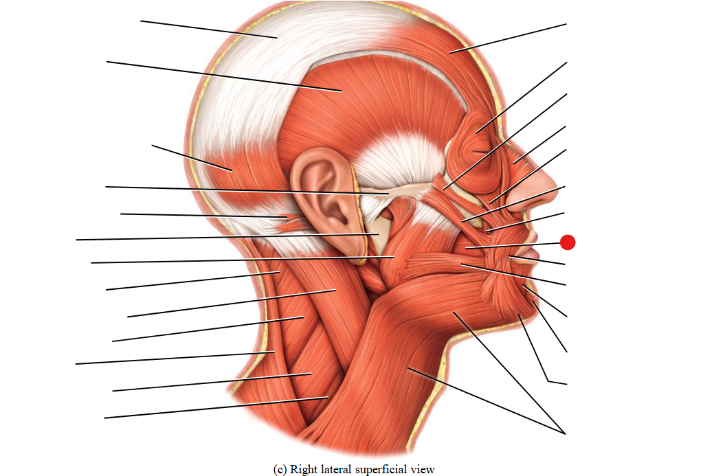 <p>Identify the structure pinned</p>