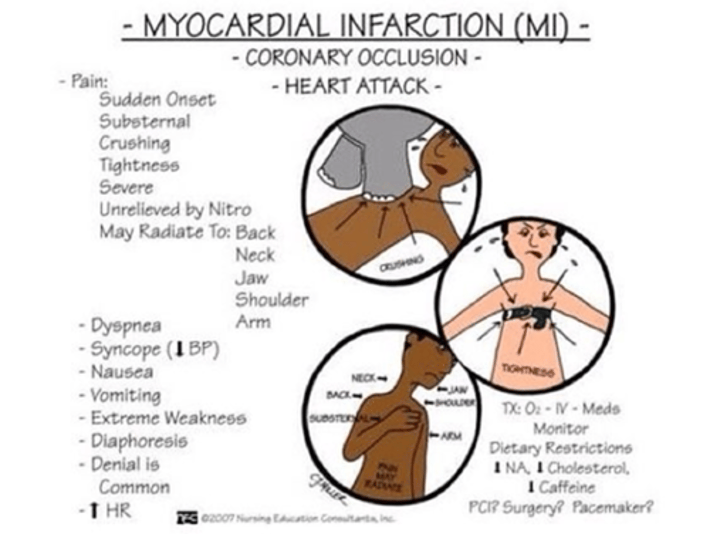 <p>B) Nausea, epigastric pain/heartburn, asymptomatic</p>