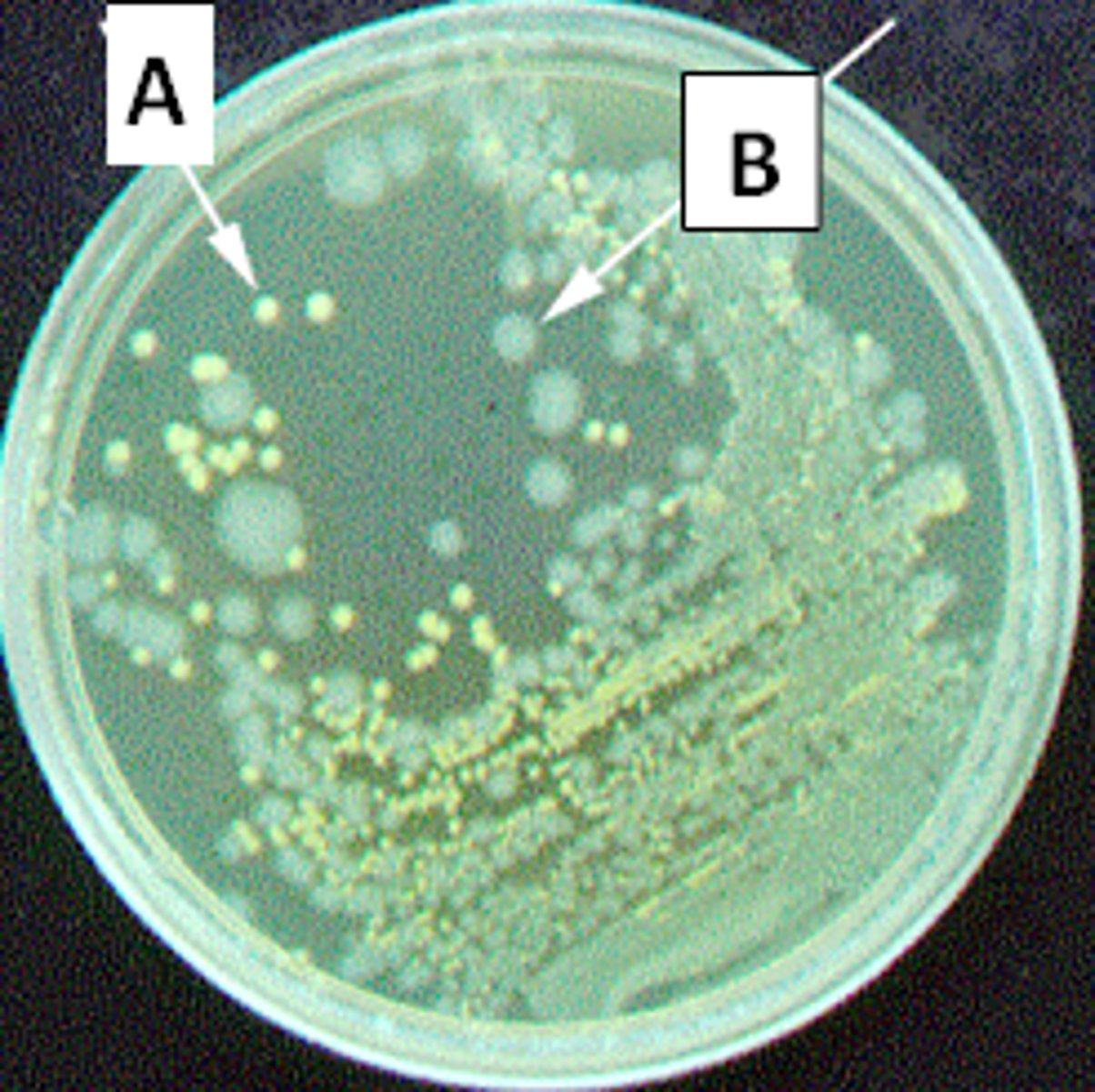 <p>An environmental (soil) sample obtained from a temperate region was transferred to a liquid growth medium and incubated at 30°C for 24 hours, then transferred to solid growth medium in order to isolate bacteria from the original sample. Following 48 hour incubation at 30°C, the picture of the solid medium shows the results of this experiment. Which of the following statement(s) among A - C are true regarding this experiment?</p><p>A. This plate represents a pure culture.</p><p>B. Isolates A and B are likely the only bacterial types that would have been present in the original environmental sample.</p><p>C. A and B are the same organism</p><p>E. NONE of A - C are correct </p>