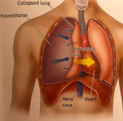 <p>high index of suspicion based on symptoms to proceed with life-saving treatment</p>