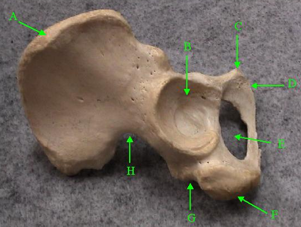 <p>What is the correct anatomical term for a movement that increases the angle of the joint?</p>