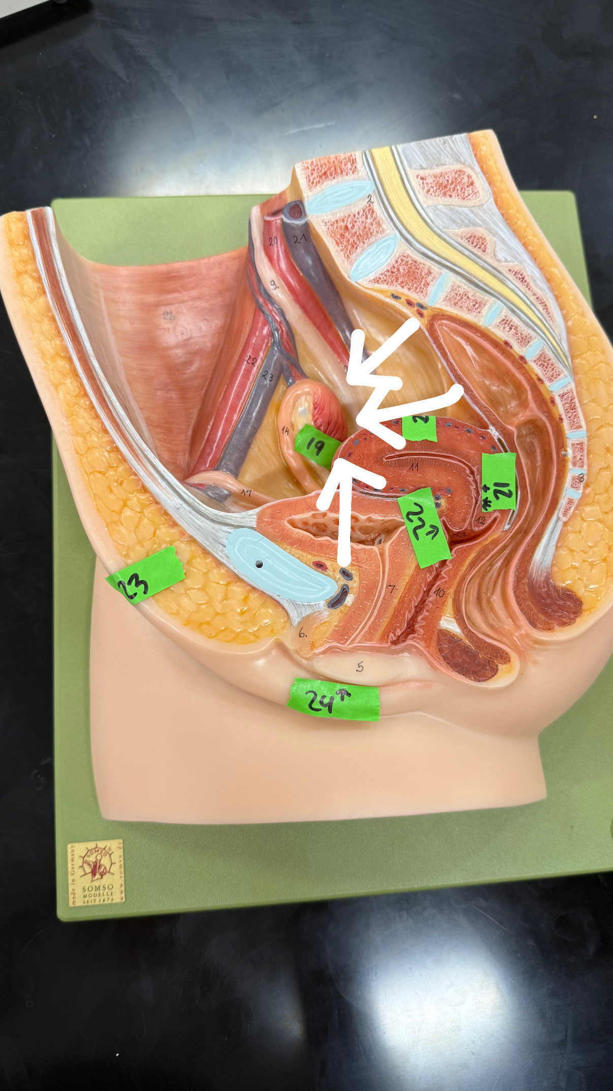 <p>finger like projections at the end of the fallopian tube</p>