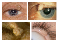 <p>What is the most likely diagnosis?</p>