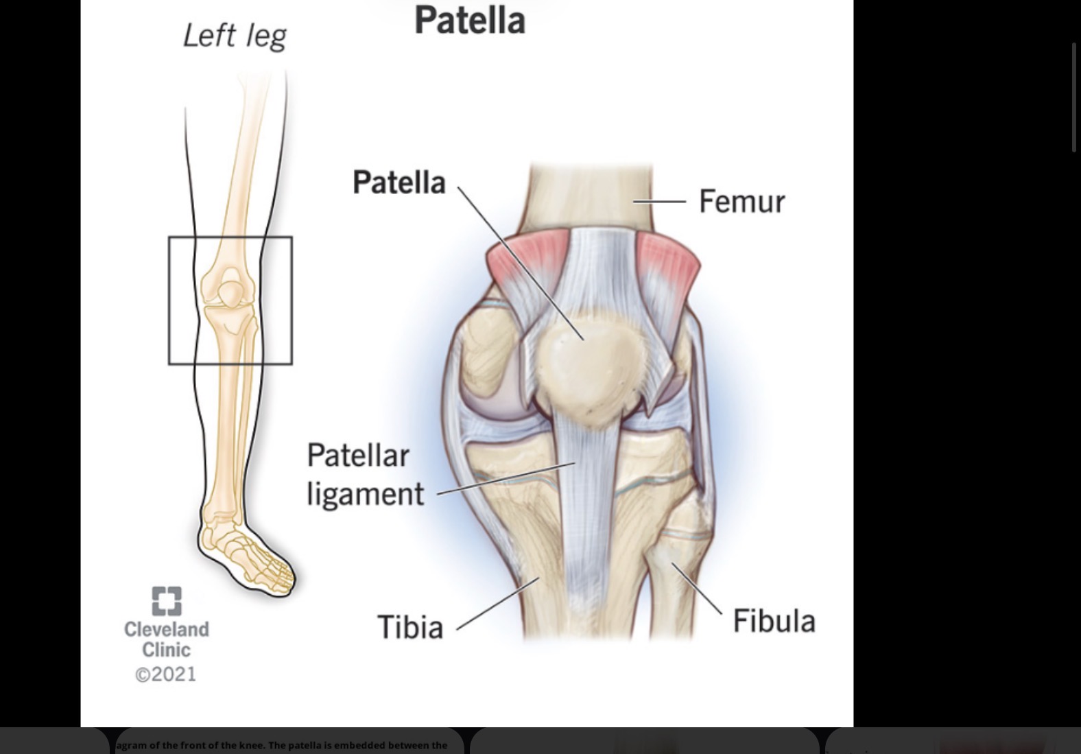 <p>Knee cap</p>