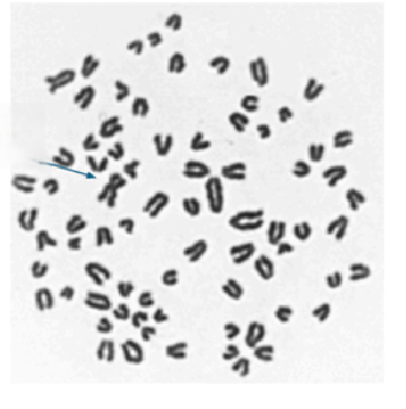 <p><span style="line-height: 20.85px;">Podaj zapis kariotypu przedstawionych poniżej przypadków (gatunek, liczbę chromosomów, płeć, rodzaj mutacji).<strong> </strong></span></p><p><span style="line-height: 20.85px;"><strong><u>Jeśli to możliwe</u></strong> wskaż chromosomy płci i ewentualne chromosomy które uległy mutacjom.</span></p>