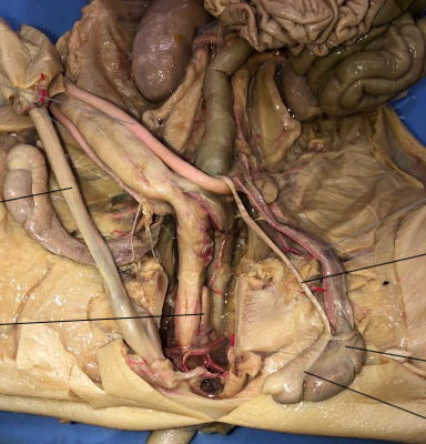 <p>Identify the vas deferens and its function</p>