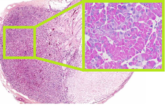 <p>Identify this tissue (What gland); Name a Hormone</p>
