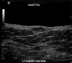 <p>Identify this image. </p>