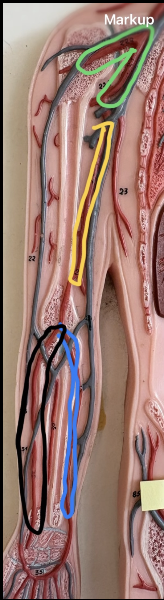 <p>What is highlighted in green?</p>