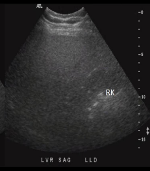 <p>Identify this image. </p>