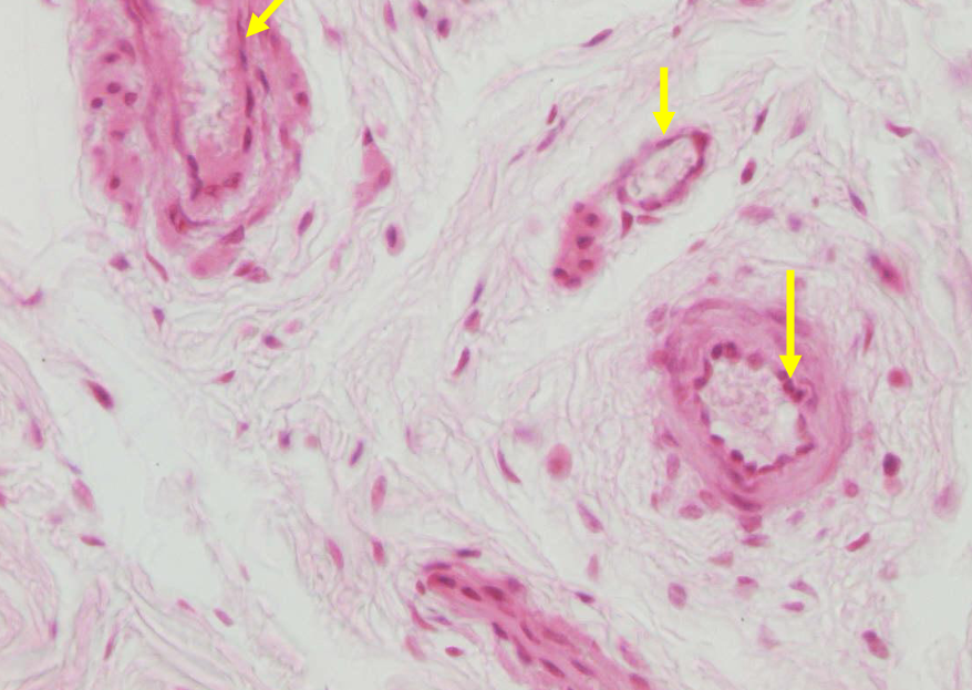 <p>welke structuur</p>