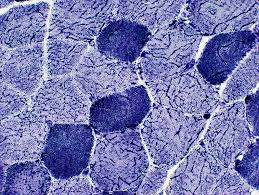 <p>phosphorylase reagents:</p><p>incubation medium:</p><ul><li><p>prevent excessive branching:</p></li><li><p>primer:</p></li><li><p>pH:</p></li><li><p>activator:</p></li></ul><p>visualizer:</p><p>mounting medium:</p><p></p>