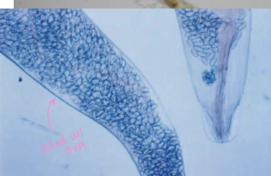 <p>what helminth is this?</p>