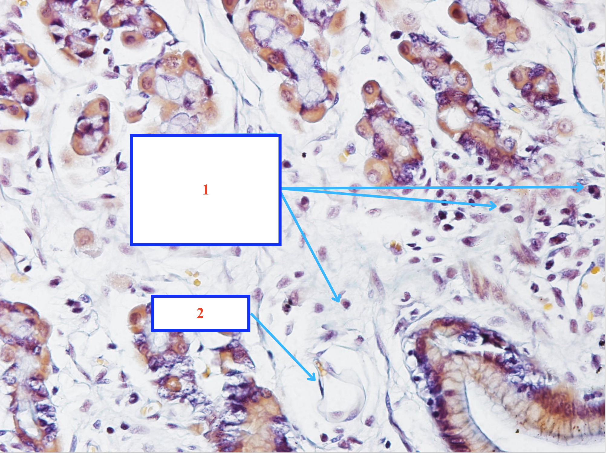 <p>Tế bào gì ?</p>