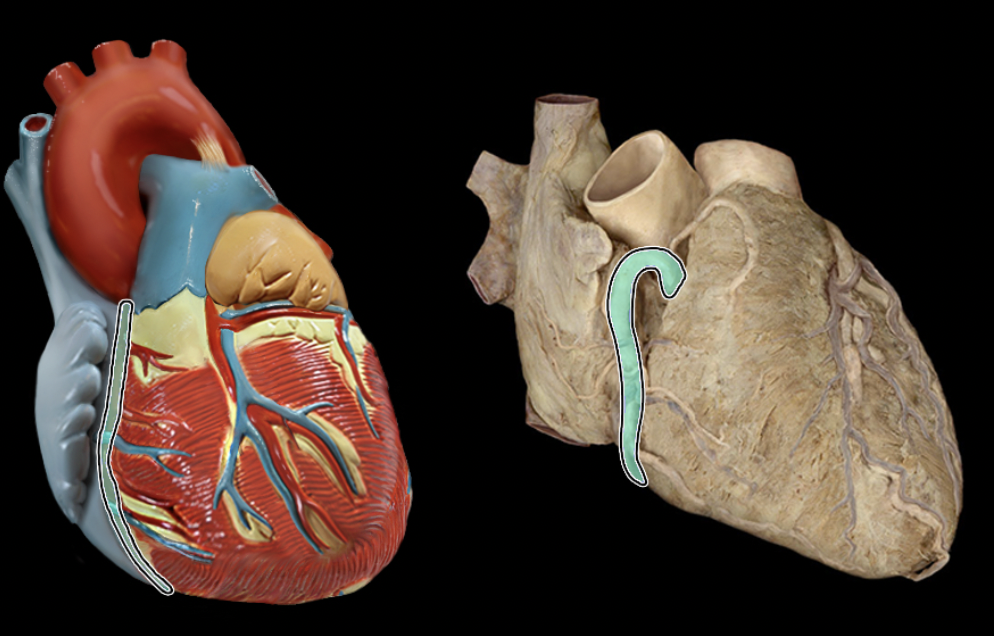 <p>Identify the coronary artery</p>