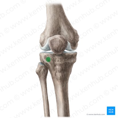 <p>IT band insertion; lateral exposure and retractor landmark.</p>
