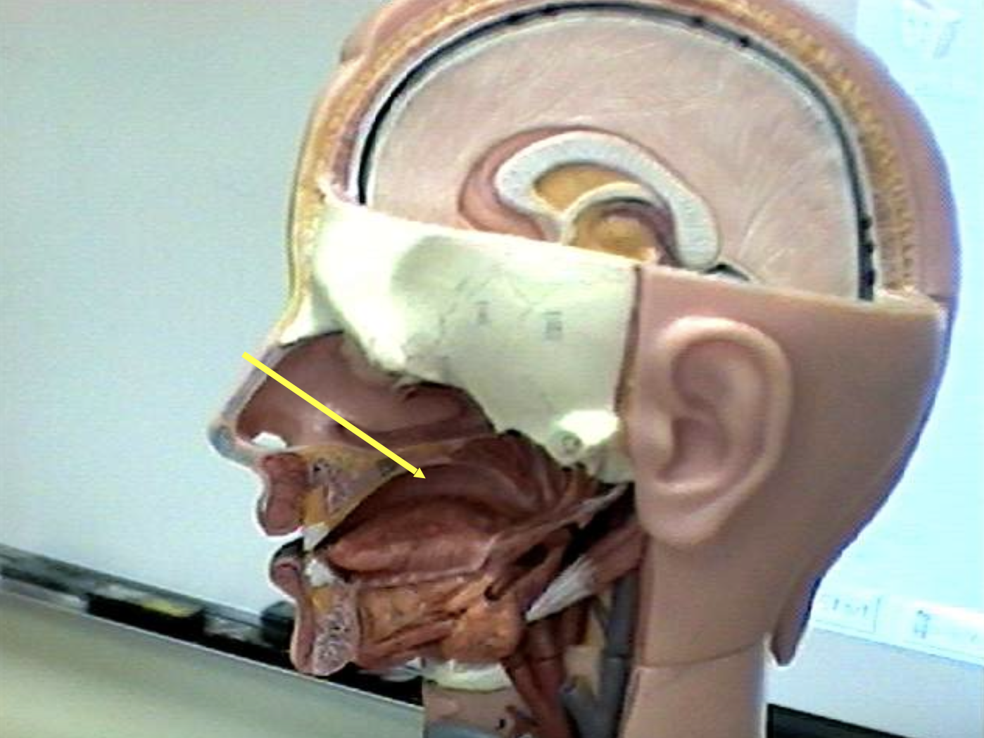 <p>Identify the organs of the digestive tract.</p>