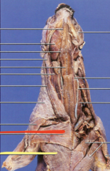 <p>what is the yellow line pointing to?</p>