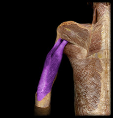 <p>Name this muscle</p>