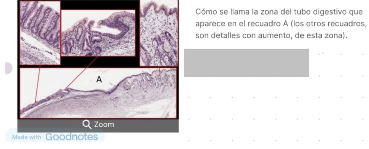 <p>zona anorrectal </p>