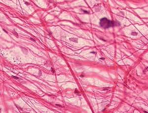 <p>common type of loose connective tissue that acts as the body's universal packing material. It supports and binds other tissues, holds organs in place, and surrounds blood vessels, nerves, and muscles using a gel-like matrix filled with protein fibers.</p>