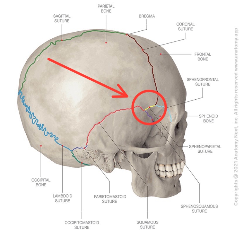 term image