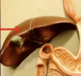 <p>What is the arrow pointing to?</p>