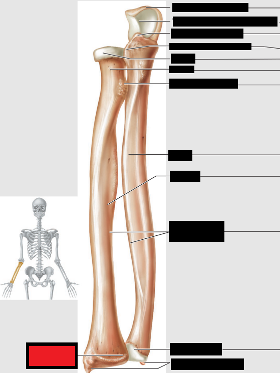 <p>Which part of the forearm is this?</p>