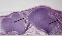 <p>What type process is occurring where the black arrows are pointing?</p>