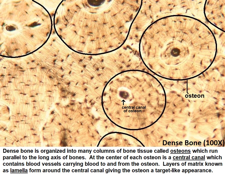 <p>Distinguish the bone type:</p>
