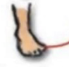 <p>Sole of foot inward</p>