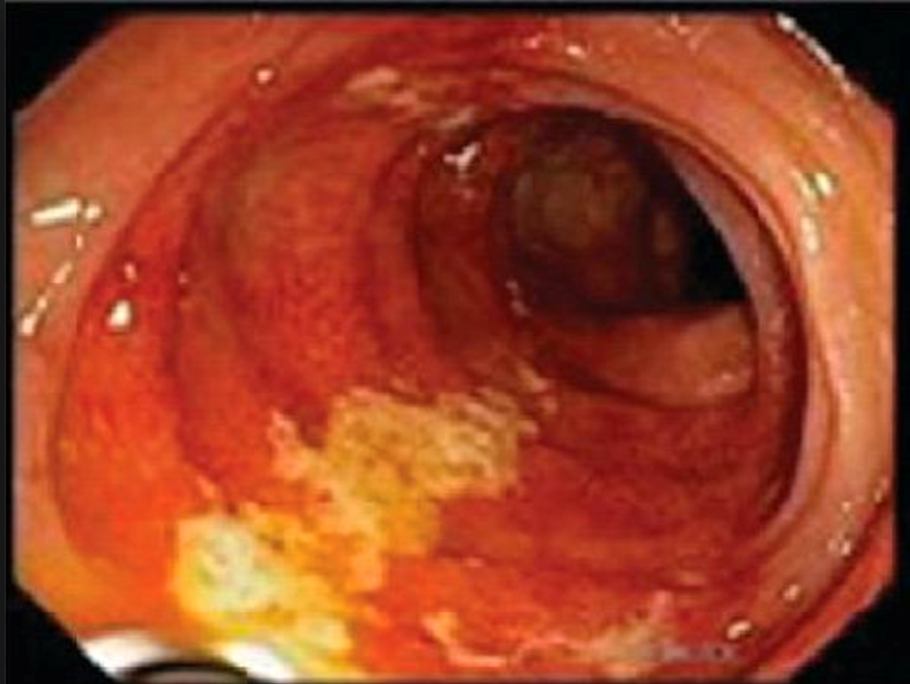 <p>white stripe sign</p>