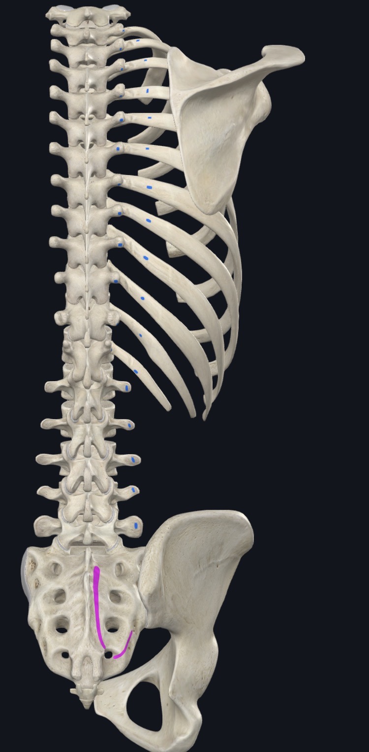 <p>TPs &amp; accessory processes L1-L5, Thoracolumbar fascia</p>