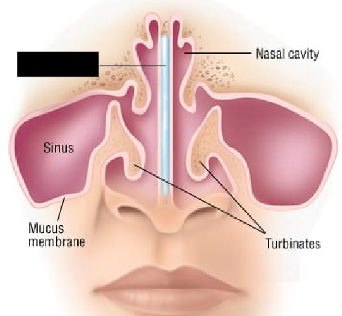 <p><span style="background-color: transparent;">Formed by two bones; divides the nasal cavity into right and left portions. The superior portion consists of the <strong>perpendicular plate </strong>of the <strong>ethmoid</strong> bone, and the inferior portion consists of the <strong>vomer</strong> bone. The anterior portion consists of cartilage.</span></p>