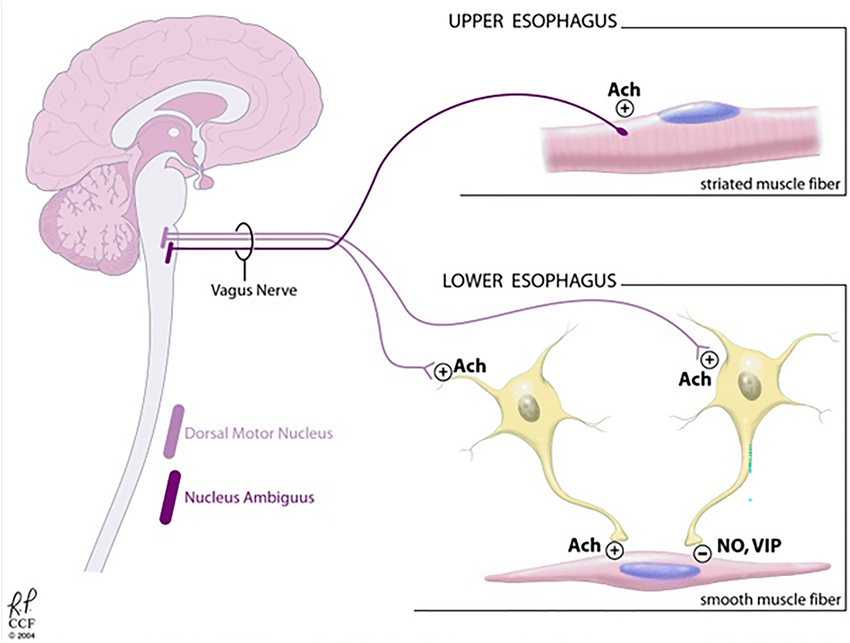 <p>Answer: The nucleus ambiguus of the medulla.</p><p>Extra Information:</p><ul><li><p>Their axons travel through the vagus nerve.</p></li><li><p>They directly stimulate striated esophageal muscle.</p></li></ul><p></p>