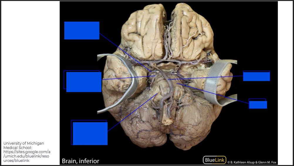 <p>Label the brain</p>